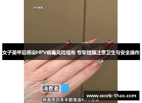 女子美甲后感染HPV病毒风险增高 专家提醒注意卫生与安全操作